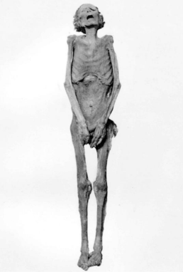 Mummified remains of Prince Pentawer, son of Ramesses III, wrapped in goatskin